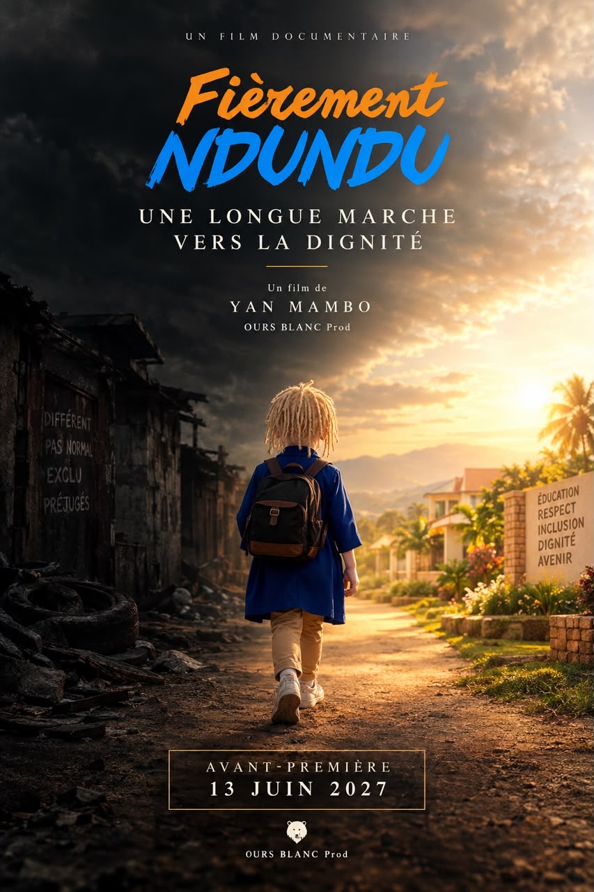 « Fièrement Ndundu » :  Bientôt un film pour raconter une décennie de combat pour la dignité des  « albinos »