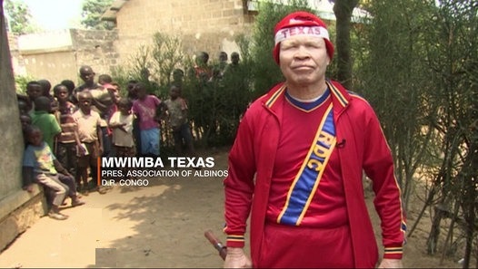 Projection à l’Upn d’un film sur l’albinisme « Mwimba Texas »
