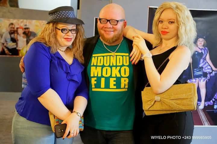 Kinshasa : “Fièrement Ndundu”, 10 ans de combat artistique pour la dignité des albinos