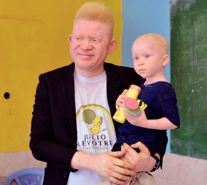 « Il faut une exonération douanière sur l’importation des produits et crèmes solaires des albinos » (Julio LeVotre)