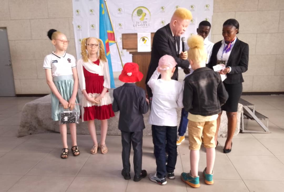 RDC : La Fondation Julio lance le projet « Kelasa » pour les enfants albinos