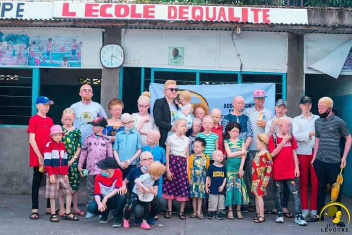Kinshasa : Matinée de réflexion sur la prise en charge scolaire des enfants albinos à Kimbaseke