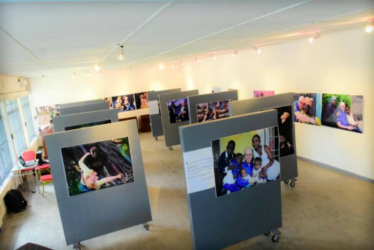 Expo-photo: Toujet Ntumba contre la stigmatisation des albinos